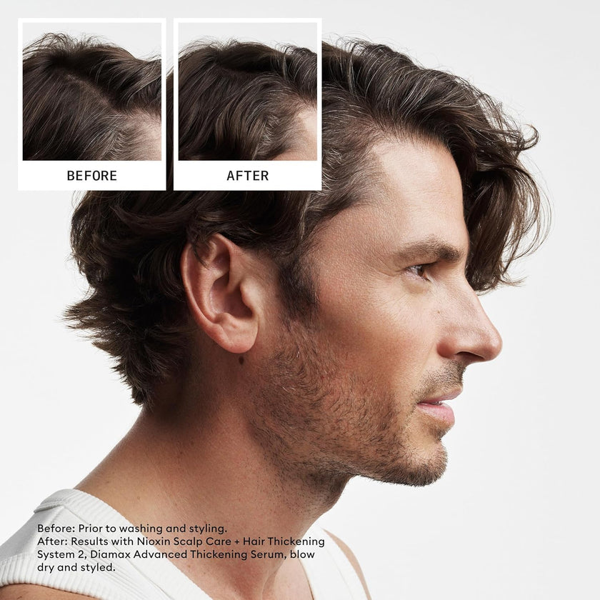 Nioxin Scalp + Hair Thickening System 2 Shampoo, For Natural Hair with Progressed Thinning, 16.9 fl oz (Packaging May Vary) 🍁 All In One Marketplace Canada