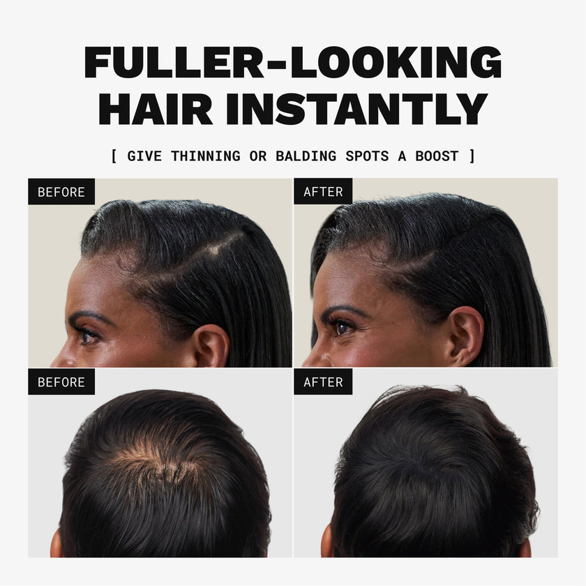 TOPPIK Hair Building Fibers, 27.5 g, Fill In Fine or Thinning Hair, Instantly Thicker Looking, Multiple Shades for Men & Women 🍁 All In One Marketplace Canada