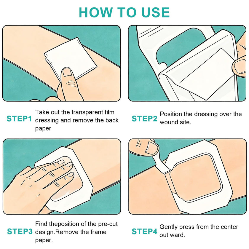 Transparent Film Dressing, 4