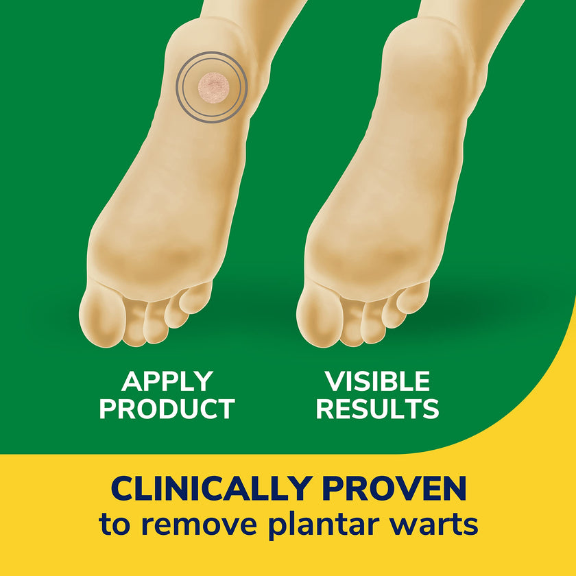 Dr. Scholl's Clear Away Wart Remover Plantar Wart,24 Count 🍁 All In One Marketplace Canada