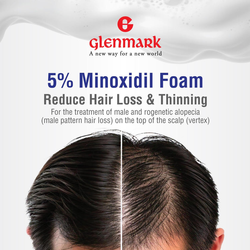Glenmark | Minoxidil 5% Hair Regrowth Foam for Men, Aerosol Can, 1 Month Treatment (60 gr) – Mess-Free, Fast-Drying Formula for Thinning Hair & Hair Loss – Reactivates Follicles 🍁 All In One Marketplace Canada