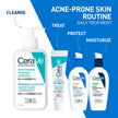 CeraVe Acne Control Gel For Face, Pimple & Pores, With Salicylic Acid, 3 Essential Ceramides, Niacinamides. Developed with Dermatologists, Non-Comedogenic, Oil-Free, Fragrance-Free, 40ml 🍁 All In One Marketplace Canada