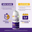 Silicone Scar Gel Scar Cream - SPF 30 Advanced Scar Gel for Old and New Scars 🍁 All In One Marketplace Canada