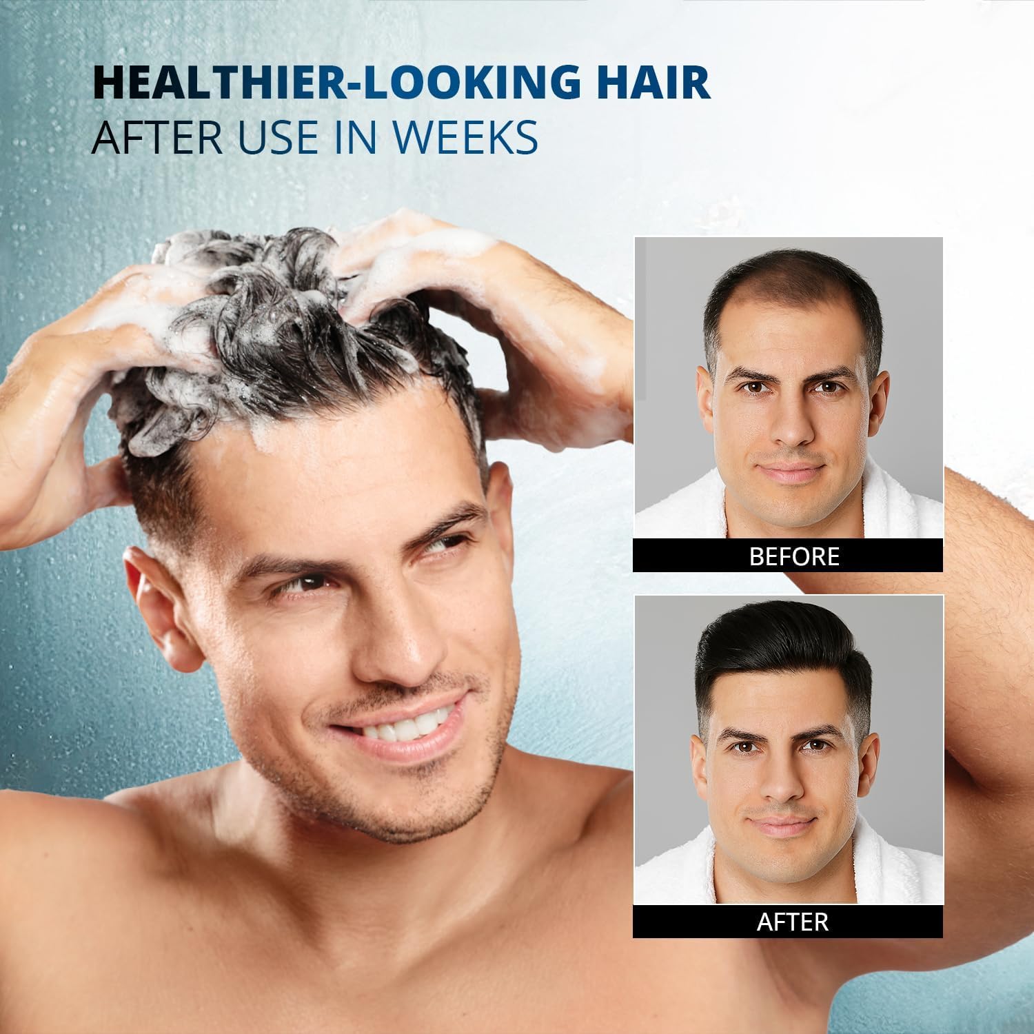 Root Activator Shampoo: 300ML Natural Volume Hair Loss Thickening Shampoo With Rosemary Strengthens Hair & Soothes Scalp For Men 🍁 All In One Marketplace Canada