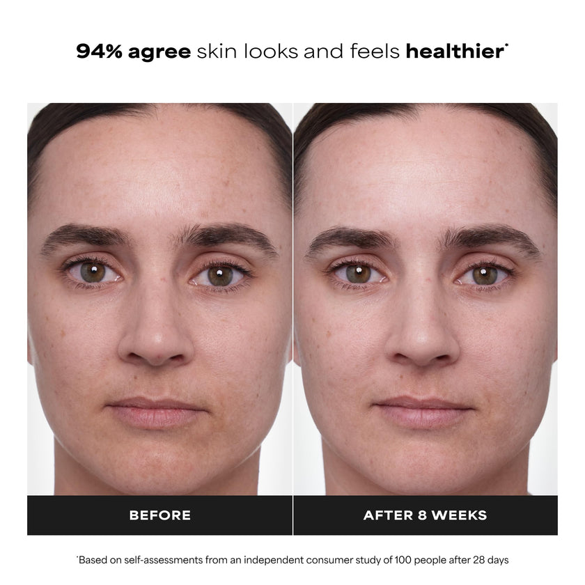 Paula's Choice CLINICAL 1% Retinol Treatment Cream with Peptides, Vitamin C & Licorice Extract, Anti-Aging Treatment for Wrinkles & Loss of Firmness, Fragrance-Free, 30 mL 🍁 All In One Marketplace Canada