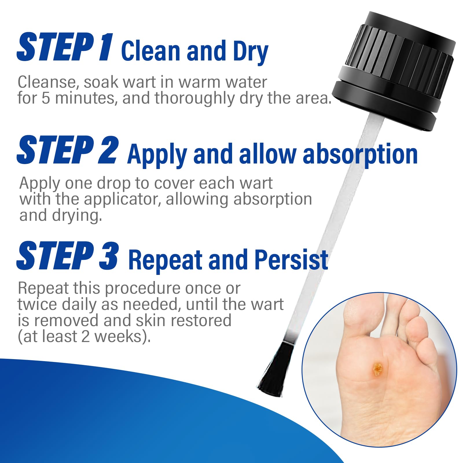 OSNOIA Extra Strength Wart Remover Liquid with 17% Salicylic Acid, Fast Acting Treatment for Plantar & Common Warts, Corn Remover for Feet and Toes (15ml, Wart Remover Set) 🍁 All In One Marketplace Canada