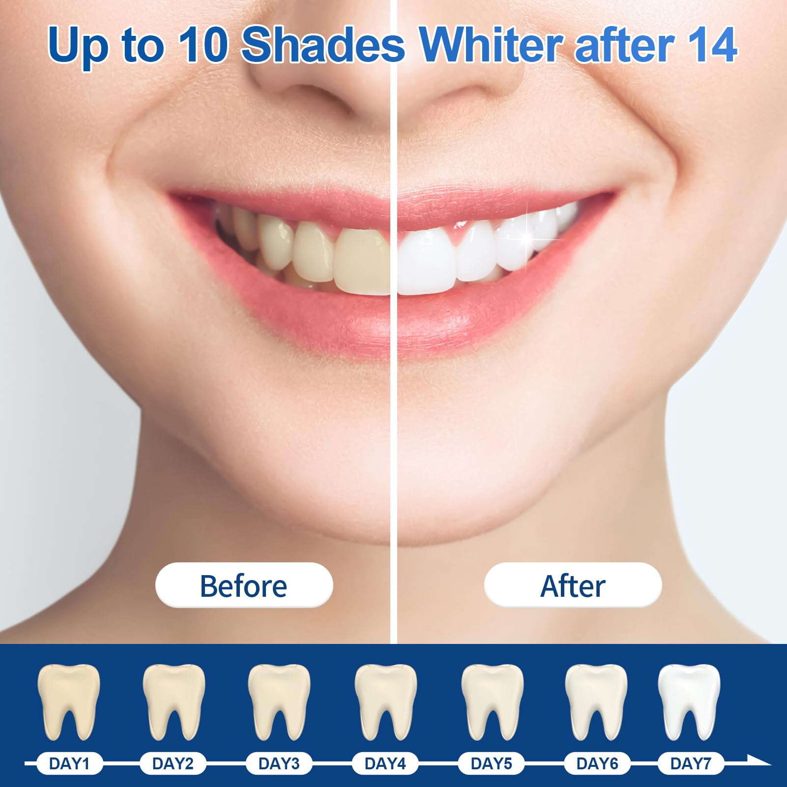 35% Ganencsnc 10-Pack Teeth Whitening Gel Refills - Gentle 35% Carbamide Peroxide Formula - Compatible with Teeth whitening Kit,No Sensitive Teeth Whitener 🍁 All In One Marketplace Canada