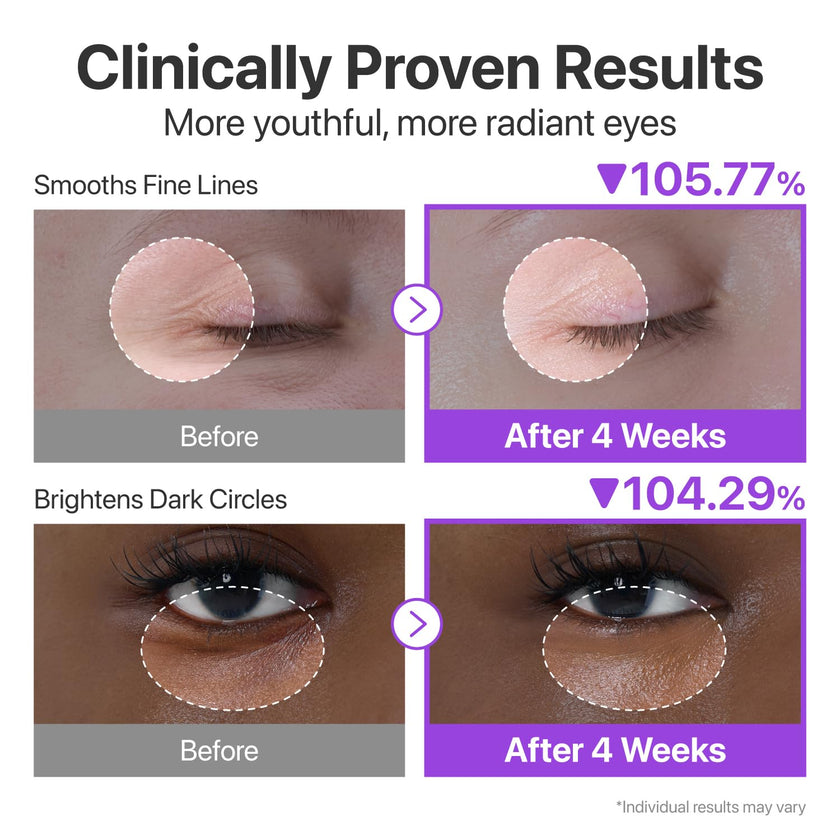 numbuzin No.9 NAD+ Retinol Eye Cream, Depuffing & Firming Eye Serum for Dark Circles, Wrinkles & Fine Lines, Peptides & Niacinamide for Glow & Undereye Radiance, Stocking Stuffers 0.33 fl oz 🍁 All In One Marketplace Canada