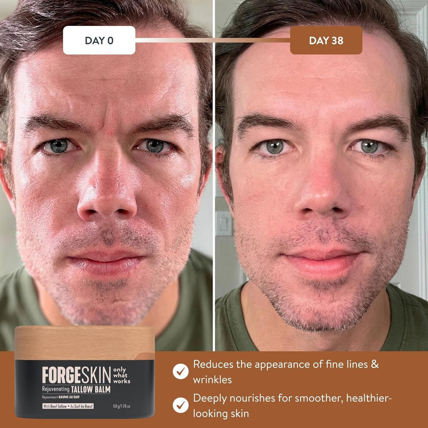 FORGE SKIN® Wrinkle Defense Beef Tallow Balm for Men [TALLOW-BASED] Moisturizer for Face Hydration - Hydrating Anti Aging Skin Cream - Natural Facial Skincare Lotion with Essential Oils (1.7 OZ) 🍁 All In One Marketplace Canada