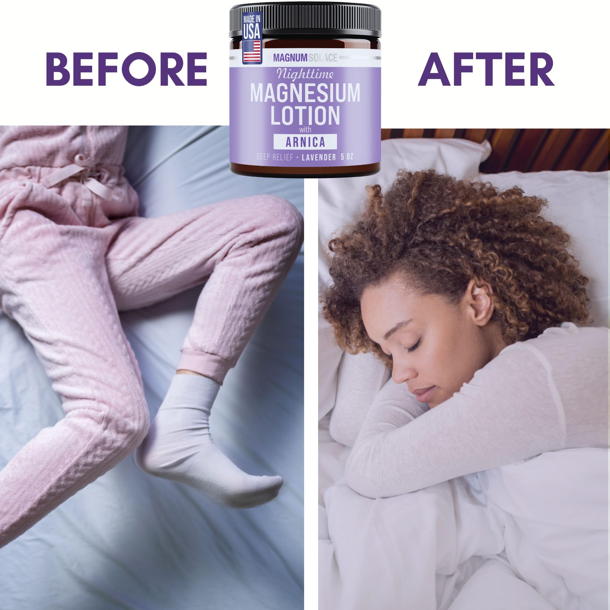 Nighttime Magnesium Lotion with Arnica – Highly Concentrated Magnesium for Muscles & Joints – Apply to Legs or Feet Before Bed – Skin-Friendly 🍁 All In One Marketplace Canada
