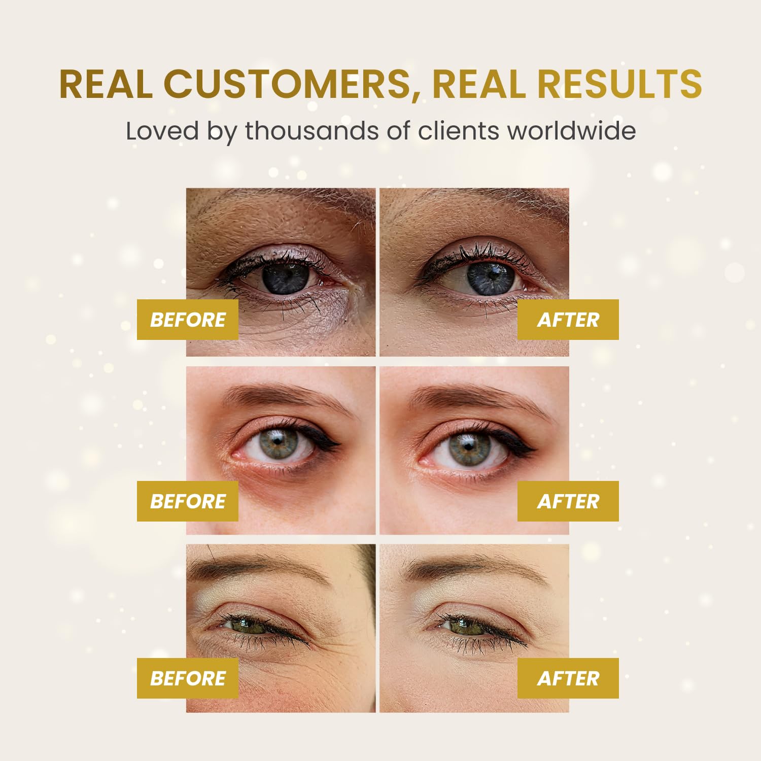 PLANTIFIQUE 24K Gold Under Eye Patches - Dermatologist Tested - 20 Pairs Cooling Eye Masks for Dark Circles & Puffiness, with Collagen & Hyaluronic Acid - Patch Yeux 🍁 All In One Marketplace Canada