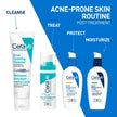 CeraVe 4% Benzoyl Peroxide Acne Treatment Foaming Cleanser Face & Body Wash, with Hyaluronic Acid and Niacinamide. Helps Clear Acne Pimples and prevent breakouts. Gentle Gel, Fragrance-Free, 150ML 🍁 All In One Marketplace Canada