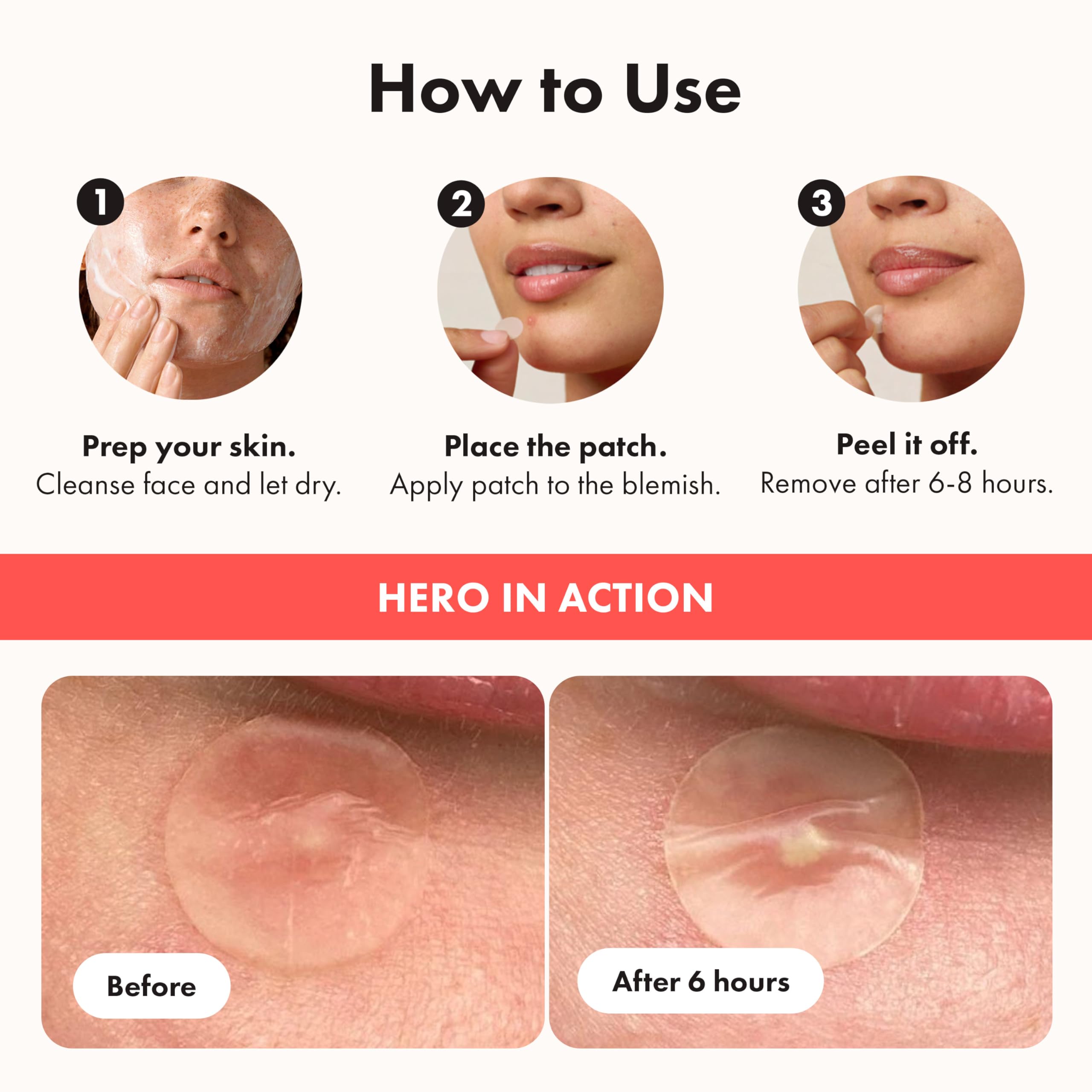 Hero Cosmetics Mighty Patch Original – Hydrocolloid Patch for Pimples, Overnight Acne Blemish & Zit Stickers for Sensitive Skin, 36 Count 🍁 All In One Marketplace Canada