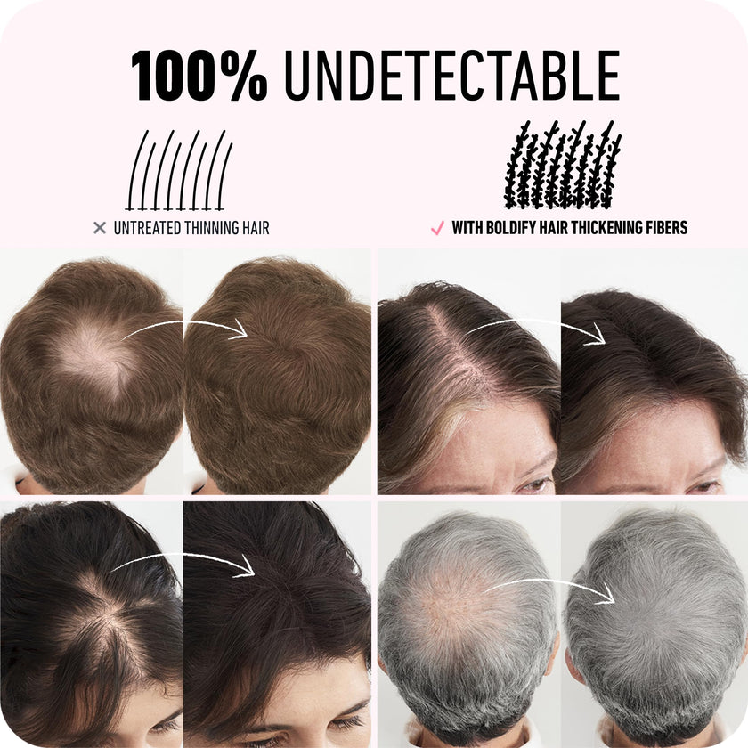BOLDIFY Hair Fibers (28g) - Fill In Thinning and Fine Hair for an Instantly Fuller, Thicker Look - 14 Shades for Women & Men - Black 🍁 All In One Marketplace Canada