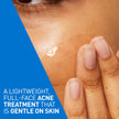 CeraVe Acne Control Gel For Face, Pimple & Pores, With Salicylic Acid, 3 Essential Ceramides, Niacinamides. Developed with Dermatologists, Non-Comedogenic, Oil-Free, Fragrance-Free, 40ml 🍁 All In One Marketplace Canada