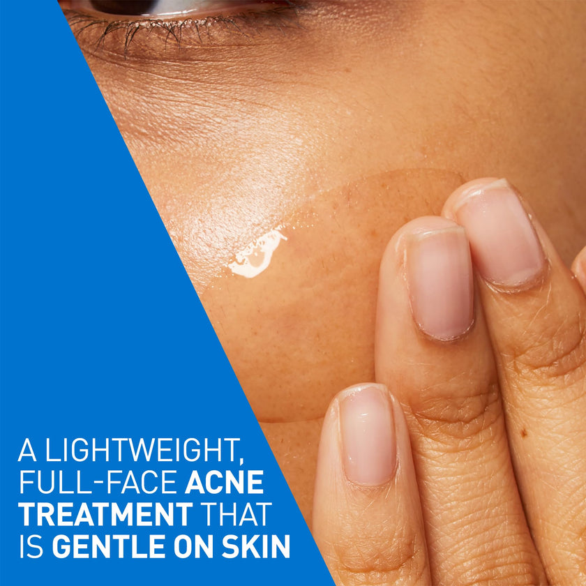 CeraVe Acne Control Gel For Face, Pimple & Pores, With Salicylic Acid, 3 Essential Ceramides, Niacinamides. Developed with Dermatologists, Non-Comedogenic, Oil-Free, Fragrance-Free, 40ml 🍁 All In One Marketplace Canada