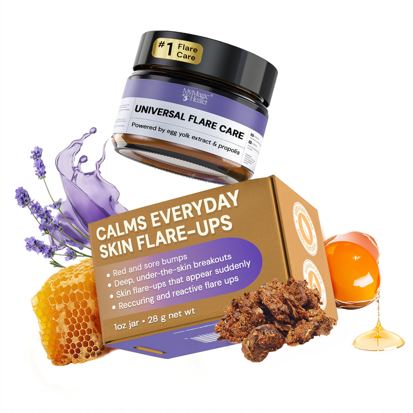 MyMagicHealer Universal Flare Care – Multi-Purpose Solution | Skin Flare-Ups - Hidradenitis Suppurativa, Folliculitis, Boils, Cysts | Anti-Chafing | Irritated Skin Relief w/Propolis & Egg Yolk 28 g 🍁 All In One Marketplace Canada