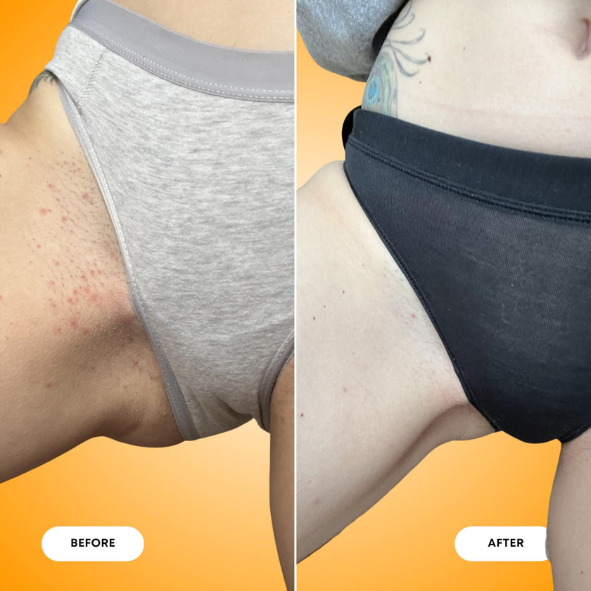 Bushbalm Ingrown Hair Exfoliating Scrub – Pre-Shave Sugar Scrub for Ingrown Hairs, Razor Bumps & Dry Skin – Gently Buffs & Soothes Sensitive Skin - Vanilla Tangerine 236 ml - Formerly Sweet Escape 🍁 All In One Marketplace Canada