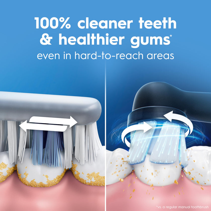 Oral-B iO2 Electric Toothbrush, for an Easy Switch to Electric, Peach, Rechargeable Electric Toothbrushes, iO Series 2 Limited with 1 Power Toothbrush, 1 Brush Head, and 1 Travel Case 🍁 All In One Marketplace Canada