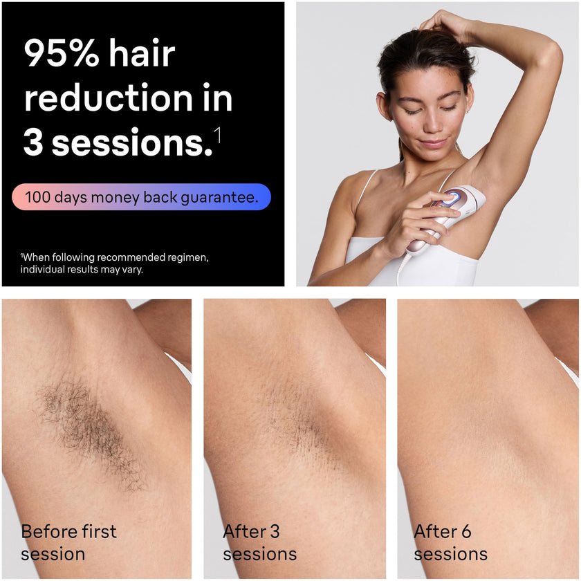 Braun IPL, Laser Hair Removal for Women & Men, Skin i-Expert IPL 7, Smart At-Home Laser with Venus Razor + 3 Heads + App, PL7243 🍁 All In One Marketplace Canada