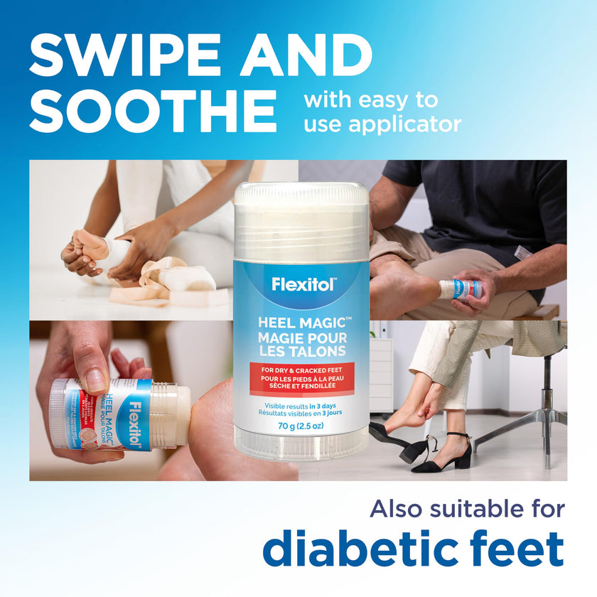 Flexitol Heel Magic for Treating Cracked and Dry Heels (70g) 🍁 All In One Marketplace Canada
