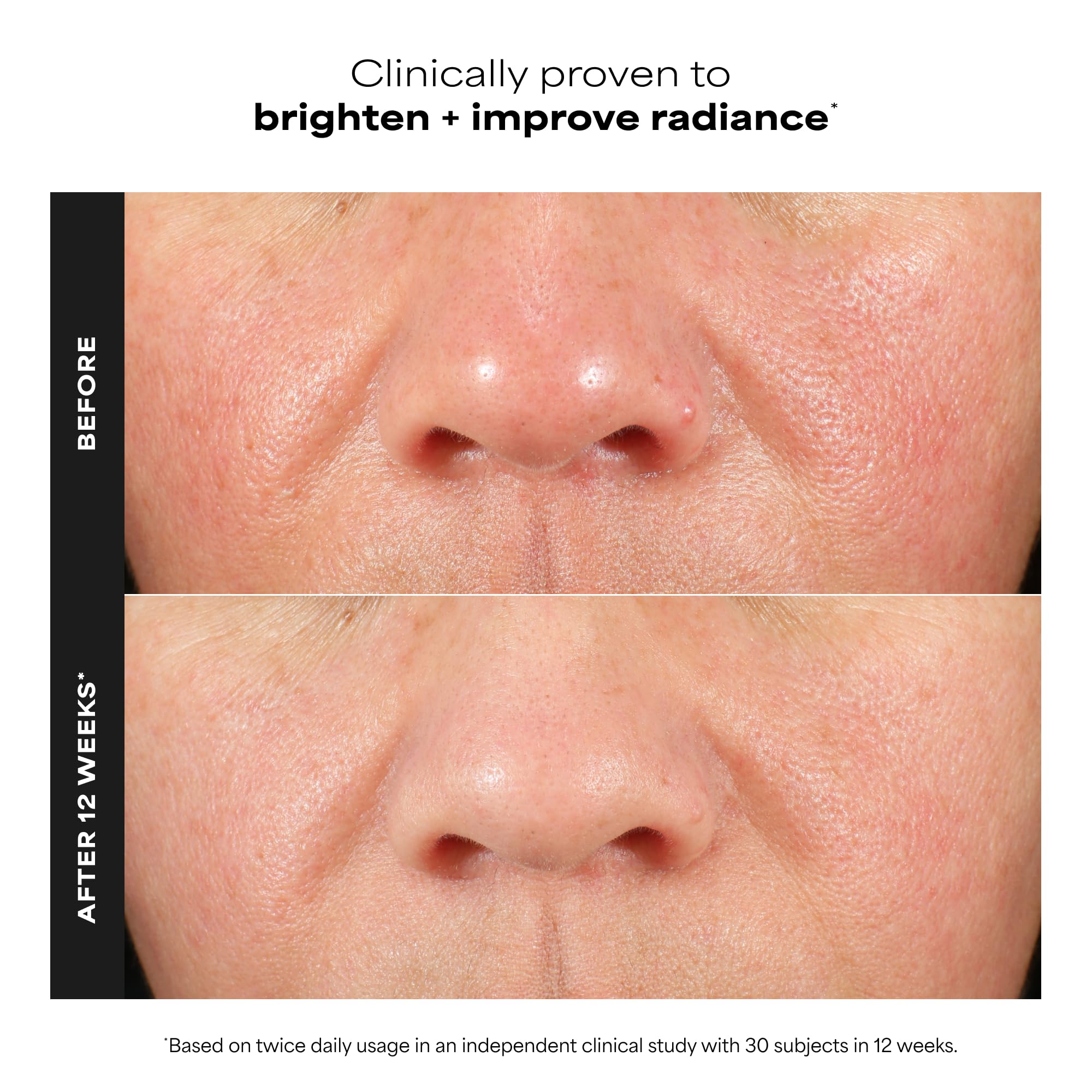 Paula's Choice C15 Super Booster, 15% Vitamin C with Vitamin E & Ferulic Acid, Brightening Serum for Discolouration, Dark Spots & Wrinkles, Fragrance-Free, 20 mL 🍁 All In One Marketplace Canada