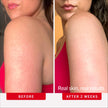 First Aid Beauty KP Bump Eraser Body Scrub Fresh Strawberry Scent, 10% AHA Keratosis Pilaris Exfoliator - Glycolic & Lactic Acid with Pumice, Treatment for Strawberry Legs, Razor Bumps & Rough Bumpy Skin, 8 oz 🍁 All In One Marketplace Canada
