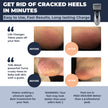 Callus Remover: Electric Rechargeable Pedicure Tools for Men/Women by Own Harmony w 3 Rollers (Tested Powerful) Best Foot File,Professional Spa Electronic Micro Pedi Feet Care Perfect for Cracked Skin 🍁 All In One Marketplace Canada