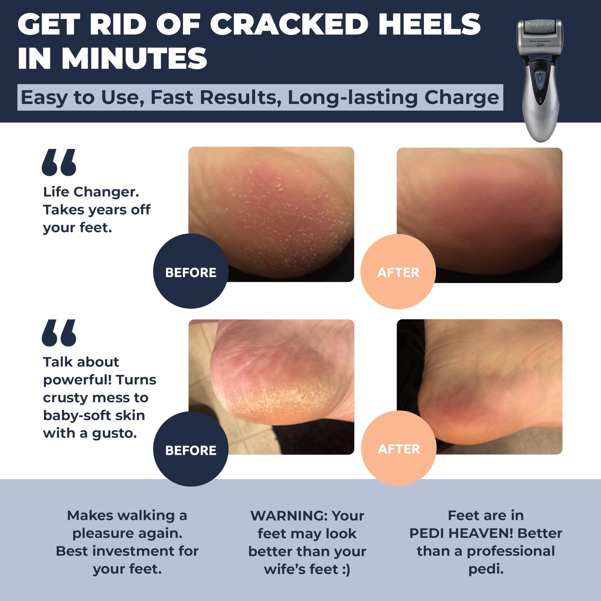 Callus Remover: Electric Rechargeable Pedicure Tools for Men/Women by Own Harmony w 3 Rollers (Tested Powerful) Best Foot File,Professional Spa Electronic Micro Pedi Feet Care Perfect for Cracked Skin 🍁 All In One Marketplace Canada