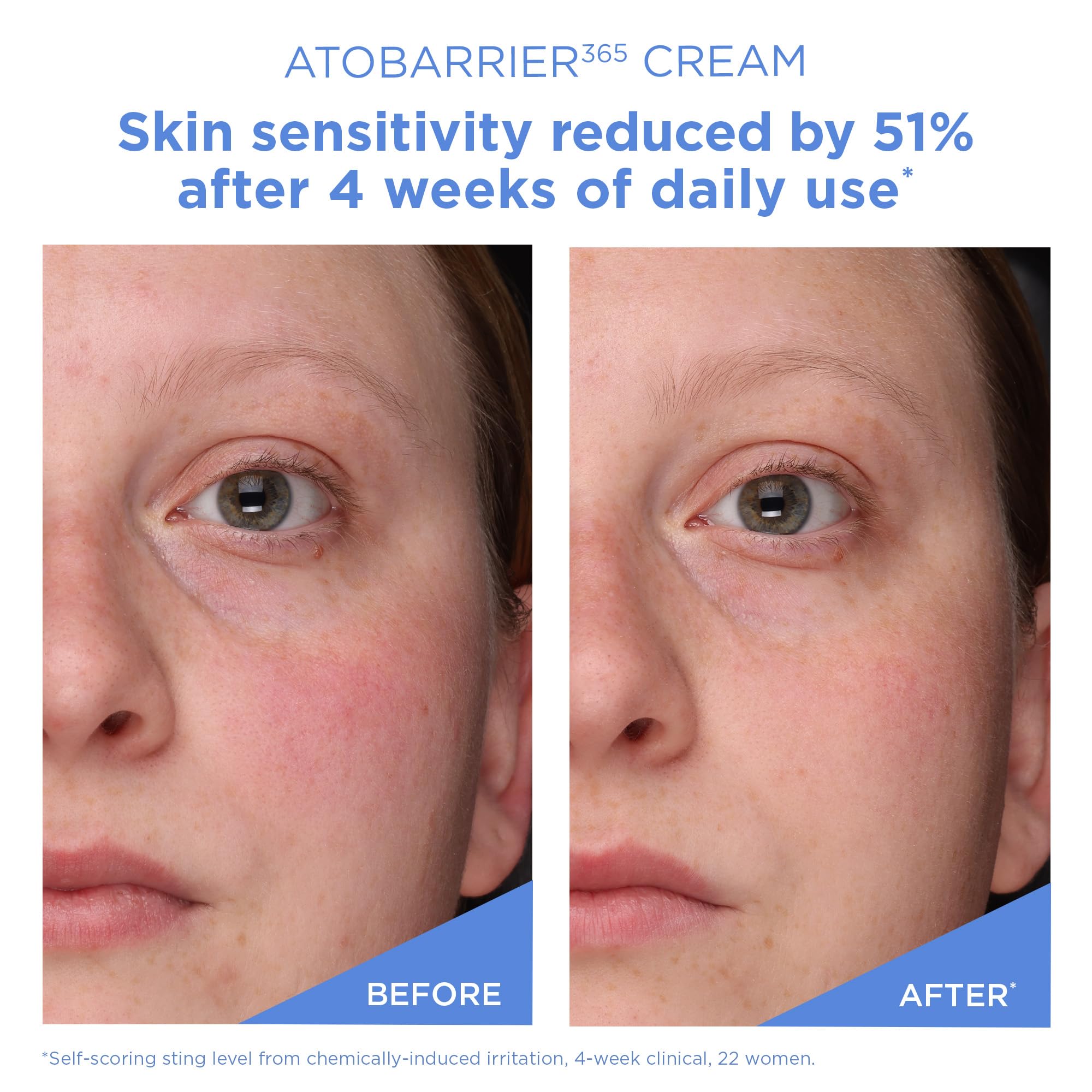 AESTURA ATOBARRIER365 Cream with Ceramides, Korean Face Moisturizer for Barrier Repair | 120H lasting Hydration, Ceramide Capsules, Dry & Sensitive Skin, Non-comedogenic, 80 mL / 2.70 fl.oz. 🍁 All In One Marketplace Canada