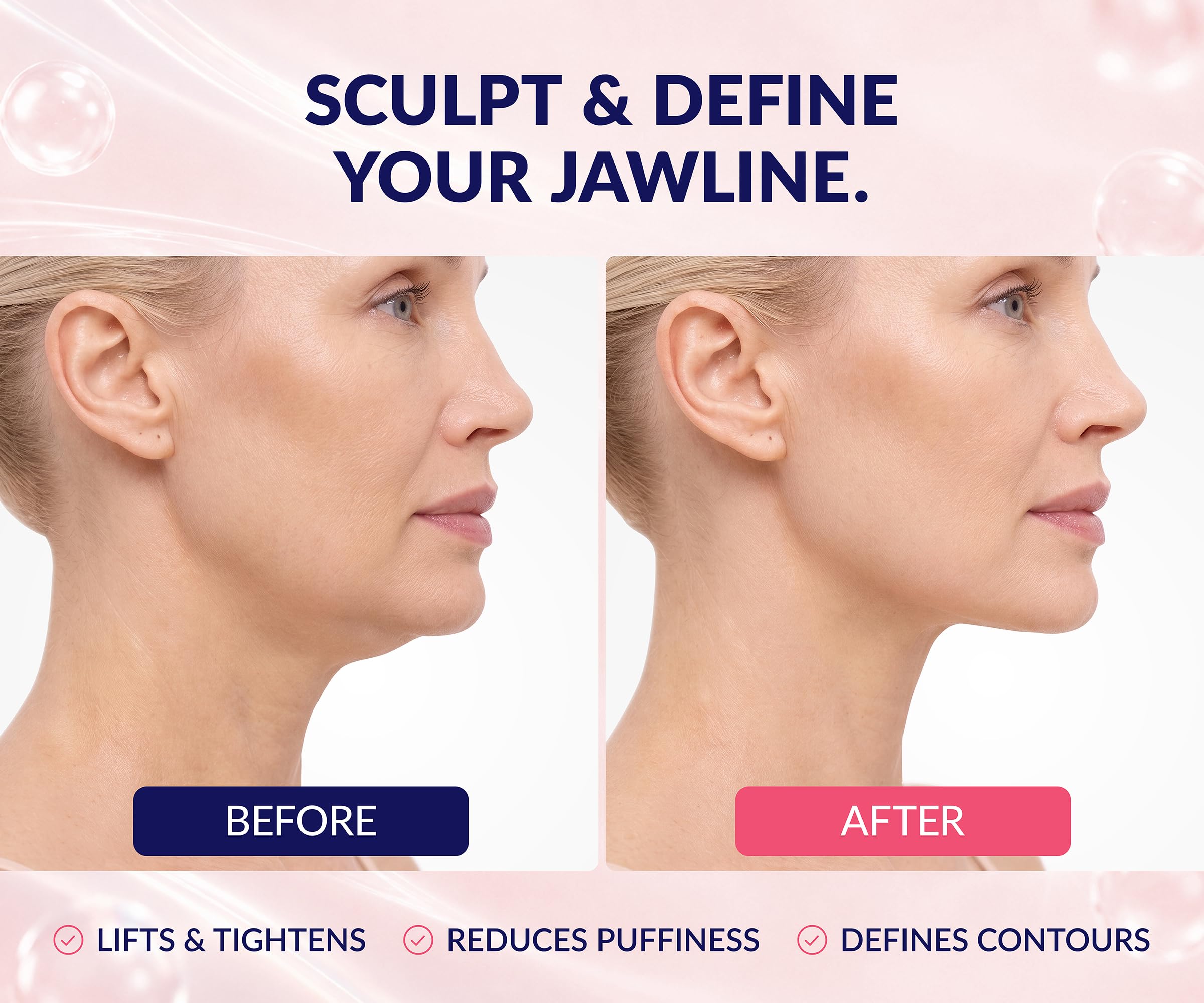 Stylia V Line Lifting Collagen Face Mask - Lift, Firm & Contour Jawline - Double Chin Strap with Hyaluronic Acid & Aloe Vera - Hydrating Neck & Face Tightening Mask - Chin Strap for Sleeping 10PC 🍁 All In One Marketplace Canada