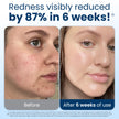 Clean Skin Club Clean Towels XL®, 100% USDA Biobased Face Towel, Disposable Face Towelette, Eczema Association Accepted, Makeup Remover Dry Wipes, Ultra Soft, 1 Pack, 50 Ct 🍁 All In One Marketplace Canada