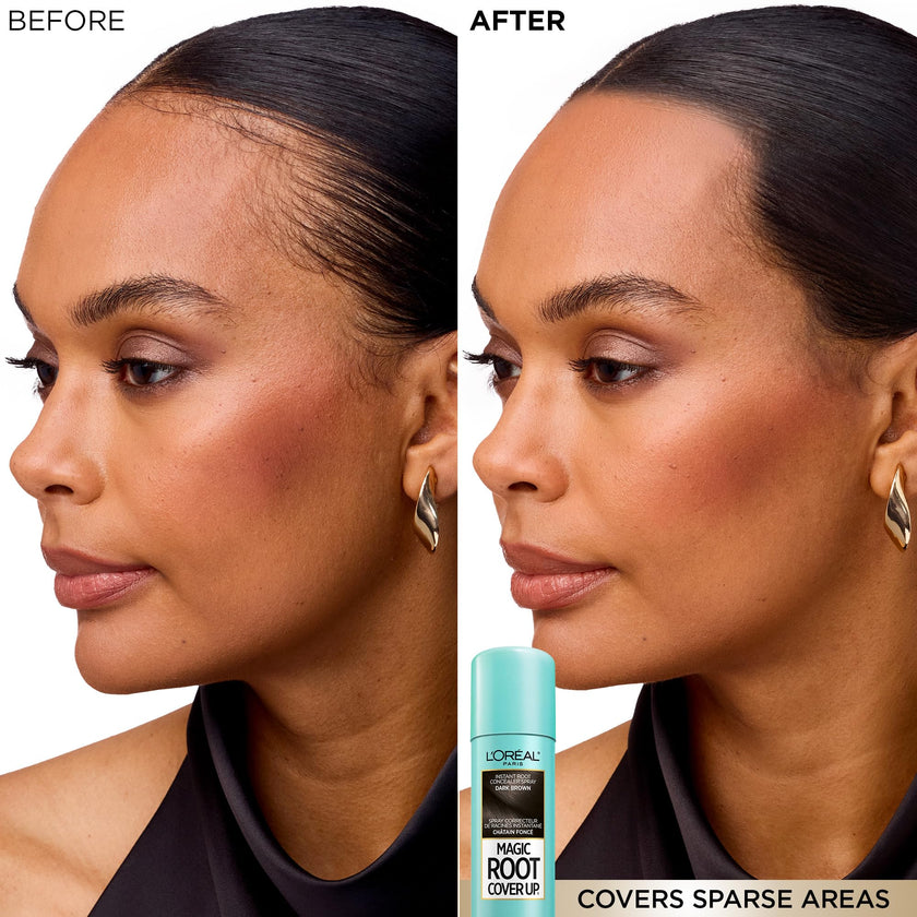 L'Oréal Paris Magic Root Cover Up Root Touch Up, Dark Brown Hair Dye, Root Touch Up Spray for Thinning Hair, Temporary Hair Dye, Grey Coverage, Pack of 2 🍁 All In One Marketplace Canada