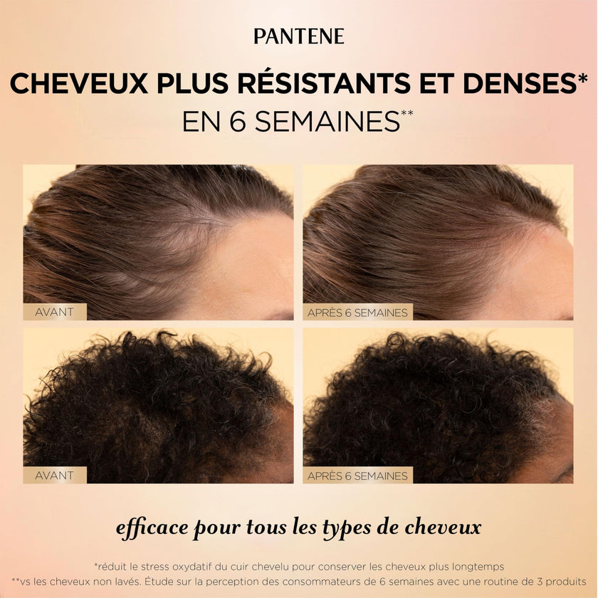 Pantene Abundant & Strong 3-Step System, Shampoo (400 ml), Conditioner (236 ml), Serum (60 ml), Strengthens at the Root, 3 Count 🍁 All In One Marketplace Canada