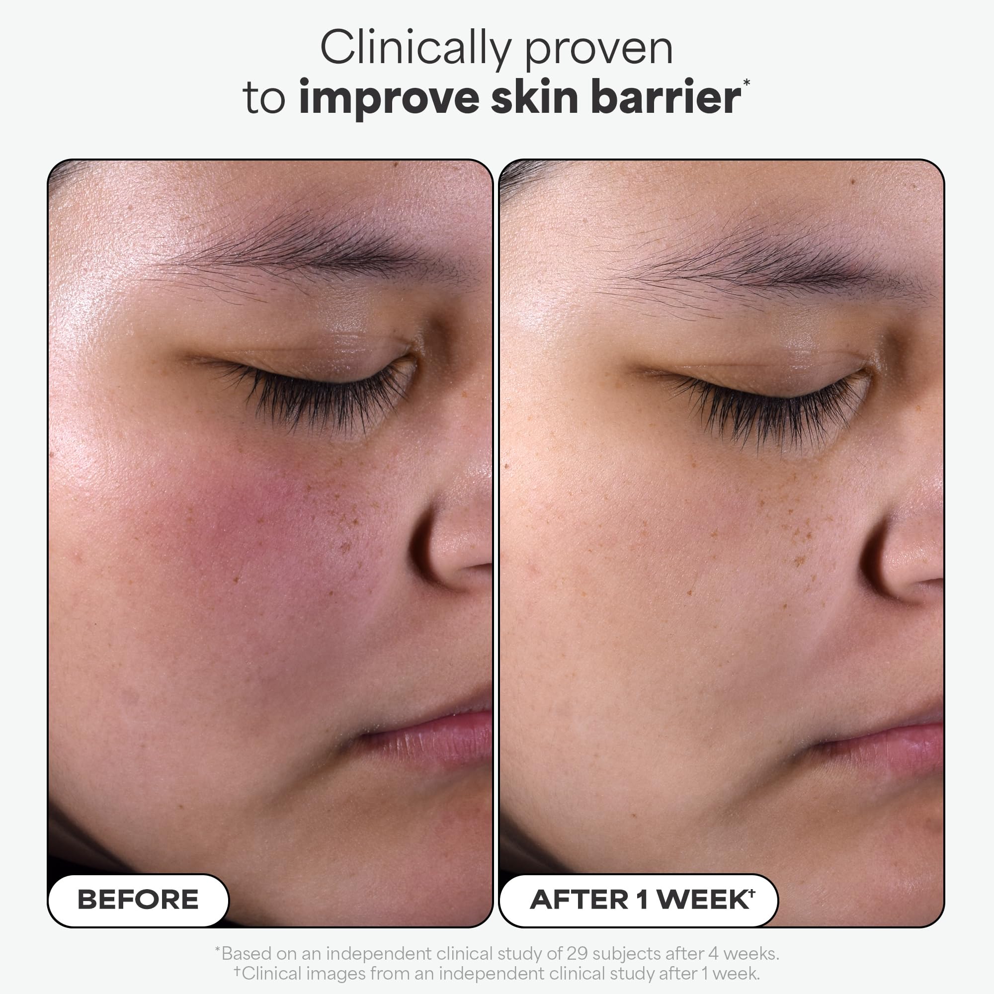 Paula's Choice SKIN PERFECTING 2% BHA Liquid Salicylic Acid Exfoliant Duo, Gentle Exfoliator for Enlarged Pores, Wrinkles & Fine Lines, Includes 1 Full Size Bottle & 1 Travel Size Bottle 🍁 All In One Marketplace Canada