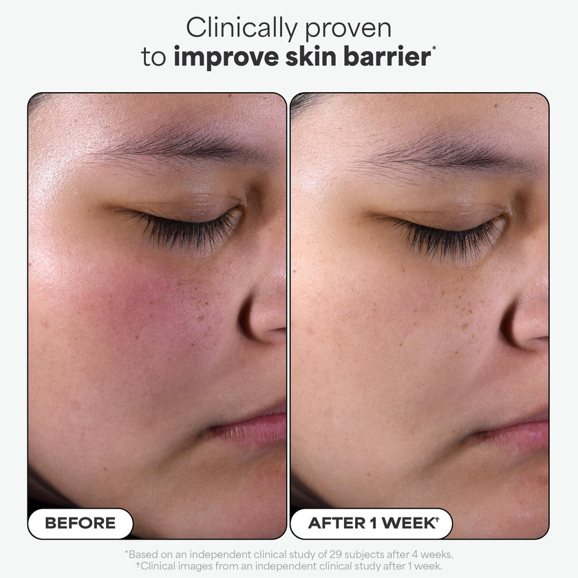 Paula's Choice SKIN PERFECTING 2% BHA Liquid Salicylic Acid Exfoliant Duo, Gentle Exfoliator for Enlarged Pores, Wrinkles & Fine Lines, Includes 1 Full Size Bottle & 1 Travel Size Bottle 🍁 All In One Marketplace Canada