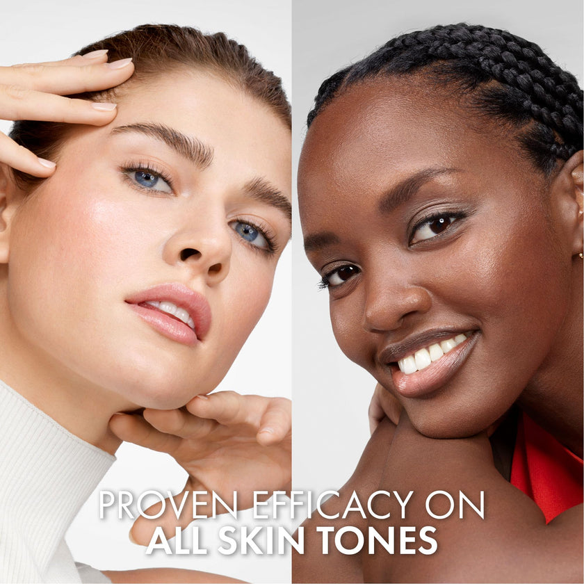 Vichy Vitamin C Serum for Face with Hyaluronic Acid & Glycerin. LiftActiv 16% Pure Vitamin C Serum for Brighter, Firmer & More Even-Toned Skin. Recognized by the Canadian Dermatology Association, 20ML 🍁 All In One Marketplace Canada