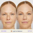 Marcelle BB Cream Beauty Balm, Light to Medium, Tinted Moisturizer, Skin Enhancer, Lightweight, Hydrating, Hypoallergenic, Non-Comedogenic, Fragrance-Free, Paraben-Free, Oil-Free, Cruelty-Free, 45 mL 🍁 All In One Marketplace Canada