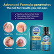 Tobcharm Nail Fungus Treatment for Toenails, Toe Nail Fungus Treatment, Nail Fungus Treatment, Toenail Fungus Treatment, Toe Fungus Treatment Extra Strength, Fungus Nail Killer, Nail Antifungal, Fungal Nail Treatment for Fingernails (30ml)