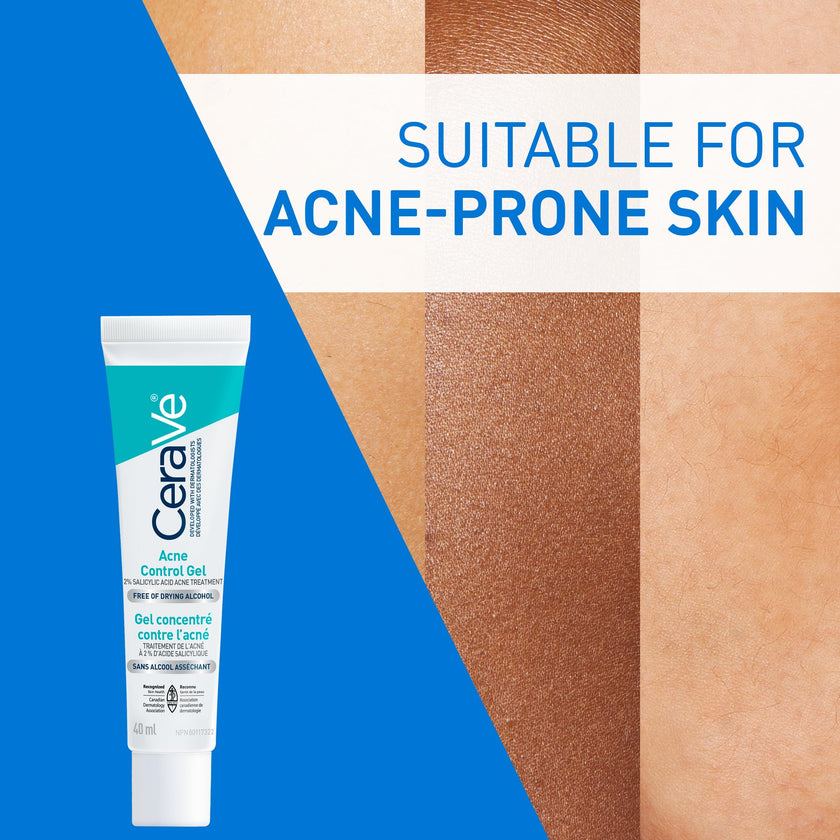 CeraVe Acne Control Gel For Face, Pimple & Pores, With Salicylic Acid, 3 Essential Ceramides, Niacinamides. Developed with Dermatologists, Non-Comedogenic, Oil-Free, Fragrance-Free, 40ml 🍁 All In One Marketplace Canada
