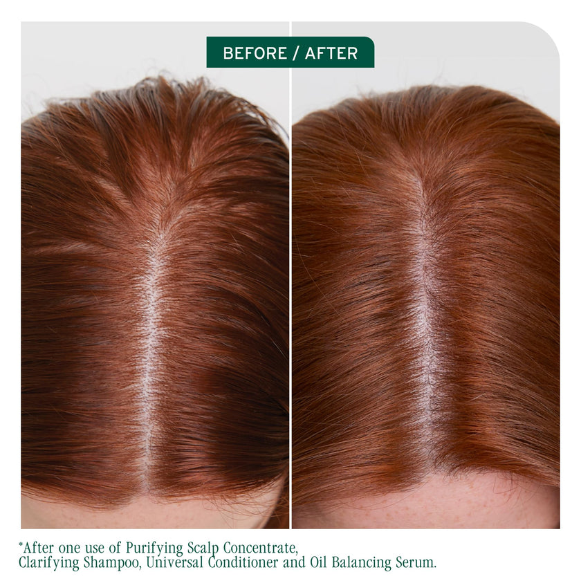 Biolage Clarifying Shampoo, Scalp Sync, Removes Residue, Buildup and Excess Oil, For Oily Hair & Scalp, Gently Exfoliates With Glycolic Acid, Paraben and Silicone Free, Vegan, Cruelty Free 🍁 All In One Marketplace Canada