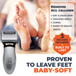 Callus Remover: Electric Rechargeable Pedicure Tools for Men/Women by Own Harmony w 3 Rollers (Tested Powerful) Best Foot File,Professional Spa Electronic Micro Pedi Feet Care Perfect for Cracked Skin 🍁 All In One Marketplace Canada