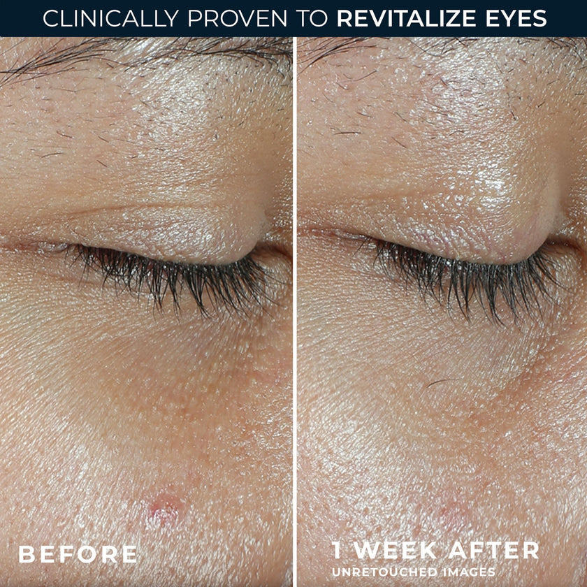 RoC Multi Correxion Revive + Glow Vitamin C with Peptides Eye Balm for Brighter Eyes 4G 🍁 All In One Marketplace Canada