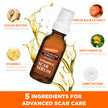 Palmer's Cocoa Butter Formula Vitamin E Scar Serum, 30ml 🍁 All In One Marketplace Canada