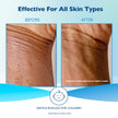Glaxal Base Moisturizing Cream, Relief from Itchy, Dry Skin, Hypoallergenic & Paraben-Free, Made in Canada, 450 g 🍁 All In One Marketplace Canada