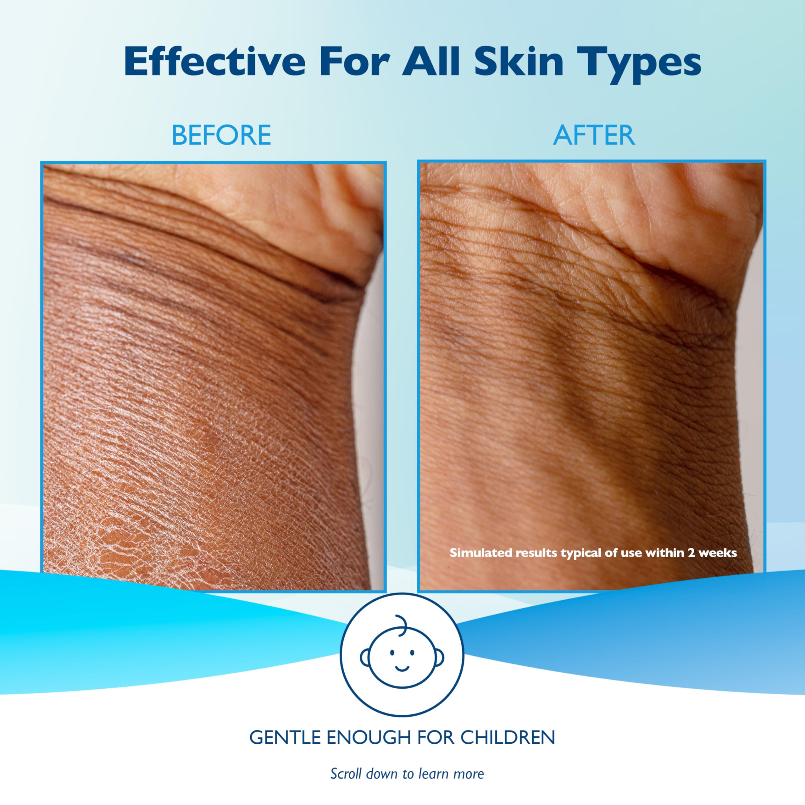 Glaxal Base Moisturizing Cream, Relief from Itchy, Dry Skin, Hypoallergenic & Paraben-Free, Made in Canada, 450 g 🍁 All In One Marketplace Canada