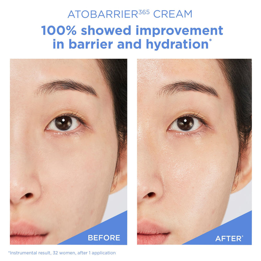 AESTURA ATOBARRIER365 Cream with Ceramides, Korean Face Moisturizer for Barrier Repair | 120H lasting Hydration, Ceramide Capsules, Dry & Sensitive Skin, Non-comedogenic, 80 mL / 2.70 fl.oz. 🍁 All In One Marketplace Canada