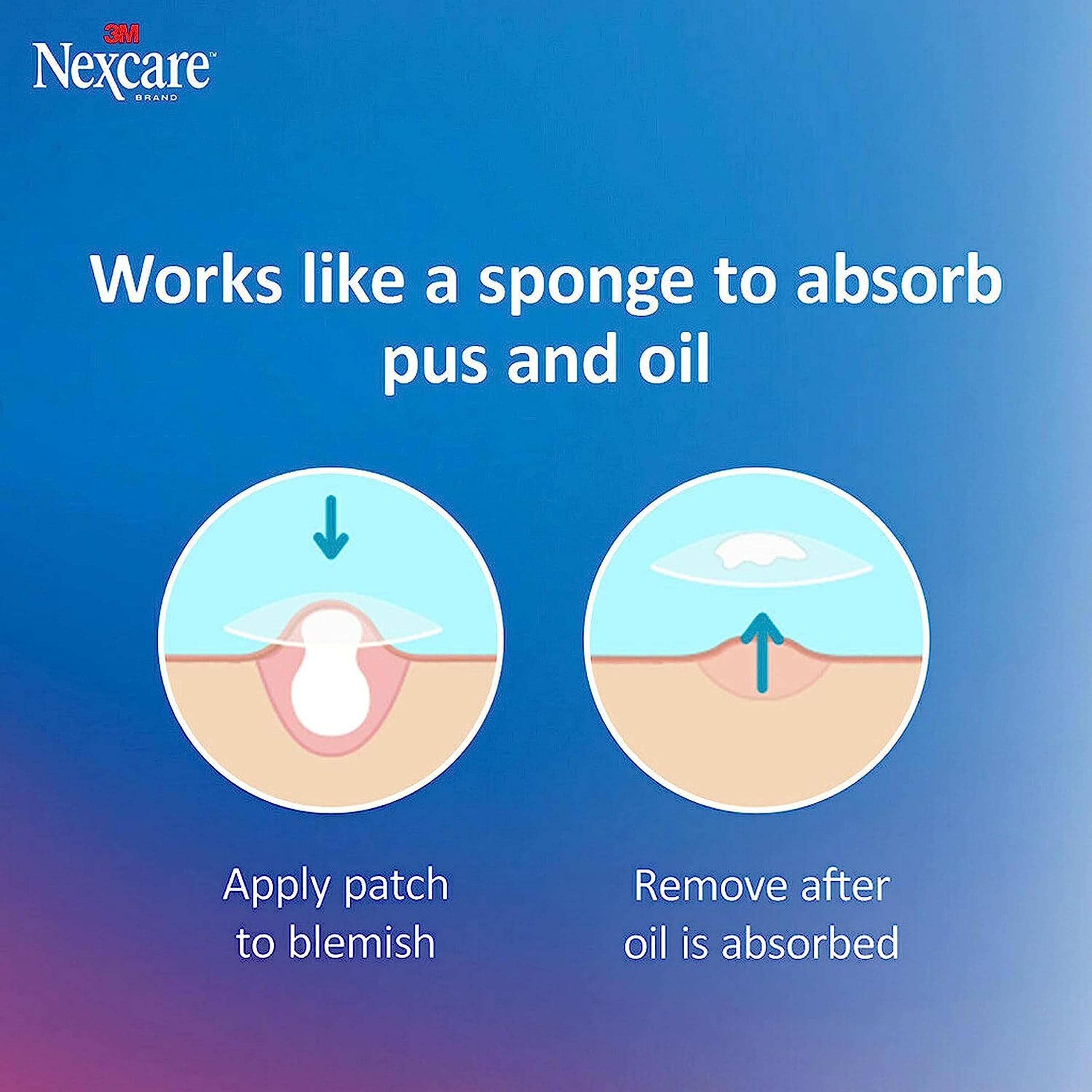 Nexcare Thin and Transparent Acne Patch, Skin Cover Absorbs Pus and Oil from Clogged Pores, Made with hydrocolloid, tab Allows for Easy Removal from Liner - 117 Pimple Patches 🍁 All In One Marketplace Canada