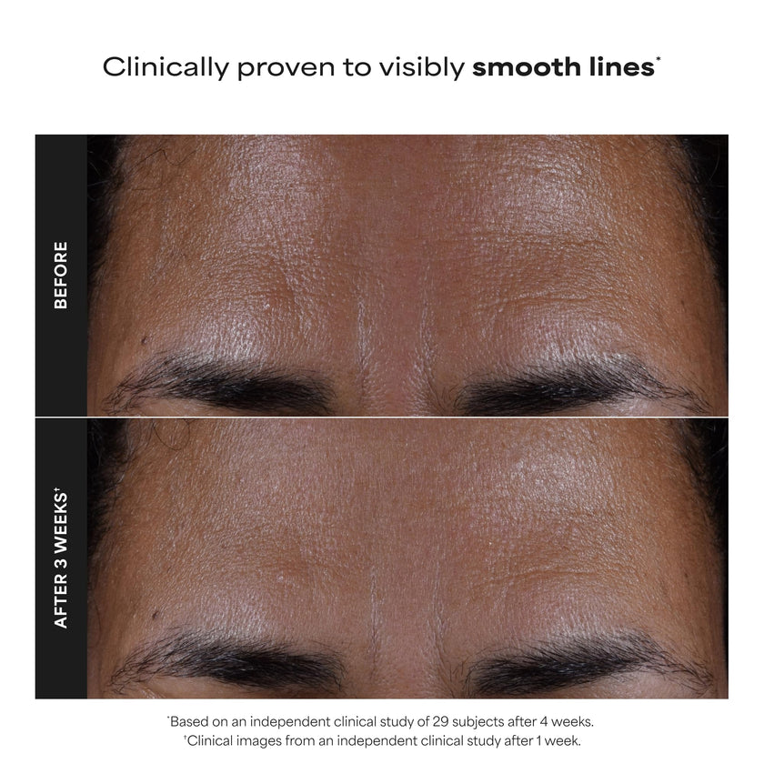 Paula's Choice SKIN PERFECTING 2% BHA Liquid Salicylic Acid Exfoliant, Daily Facial Exfoliator for Enlarged Pores, Wrinkles & Fine Lines, Fragrance-Free, Full Size - 118 ml 🍁 All In One Marketplace Canada