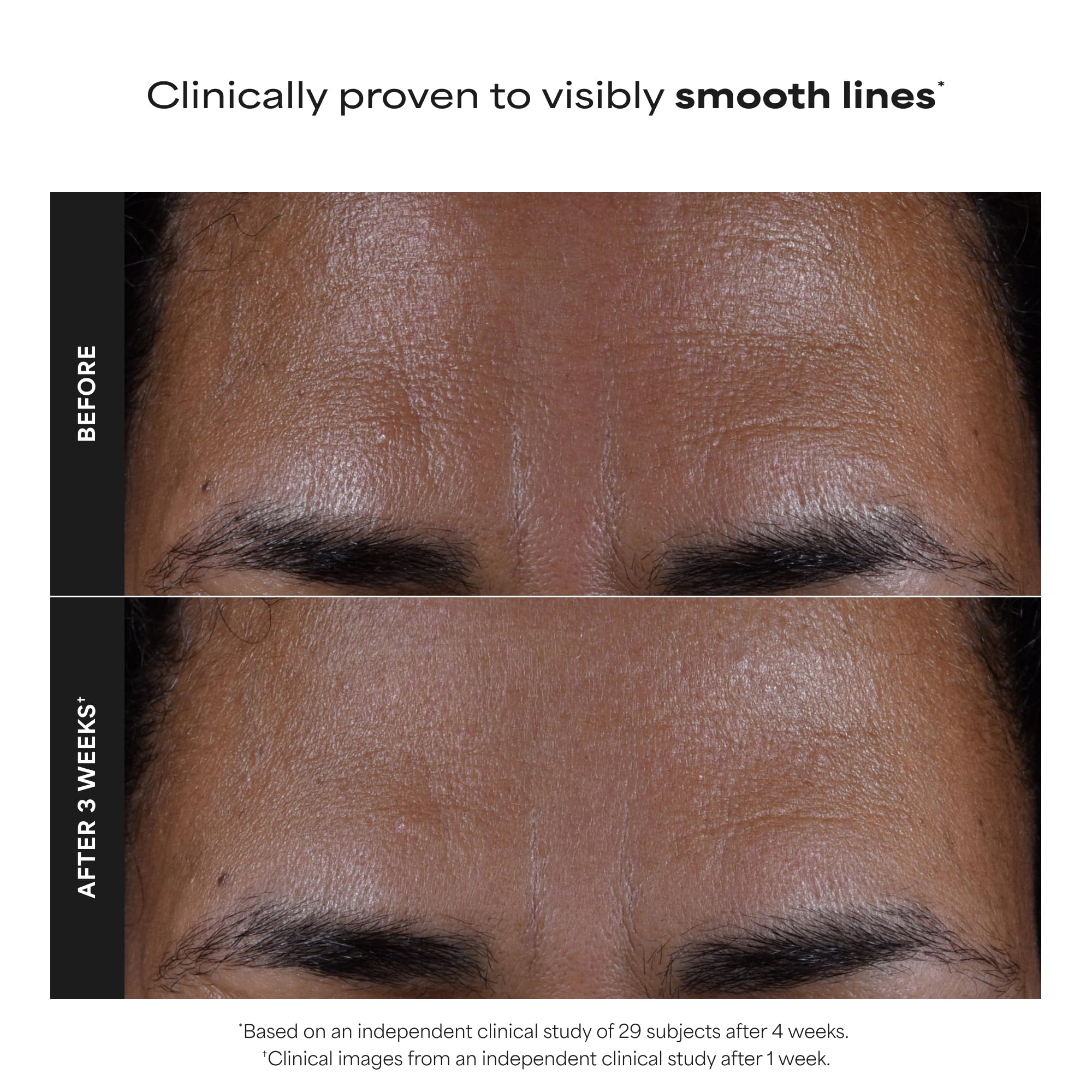 Paula's Choice SKIN PERFECTING 2% BHA Liquid Salicylic Acid Exfoliant, Daily Facial Exfoliator for Enlarged Pores, Wrinkles & Fine Lines, Fragrance-Free, Travel Size - 30 ml 🍁 All In One Marketplace Canada